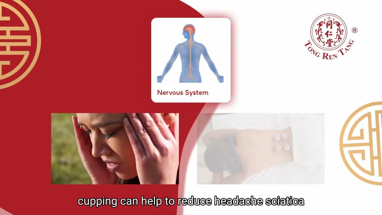 Benefits of Cupping