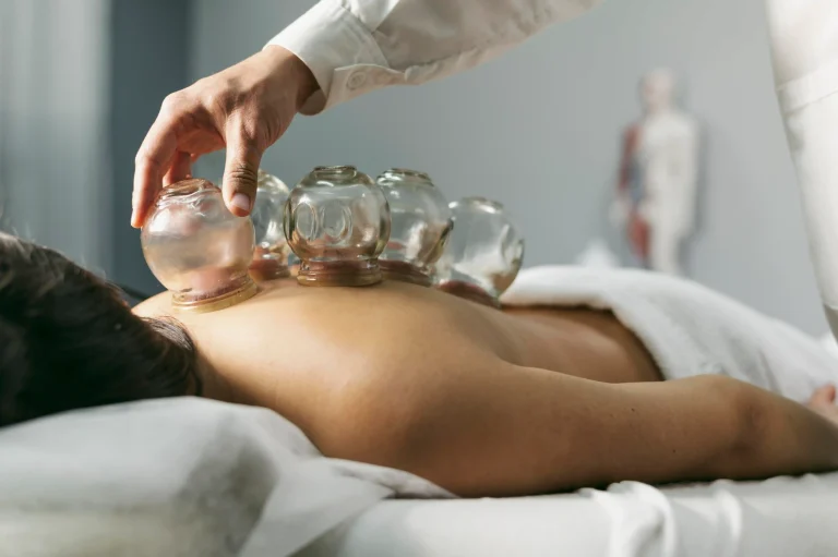 Cupping Therapy for Chronic Pain