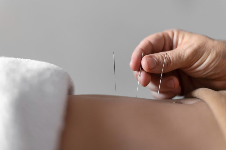 Acupuncture for Fertility