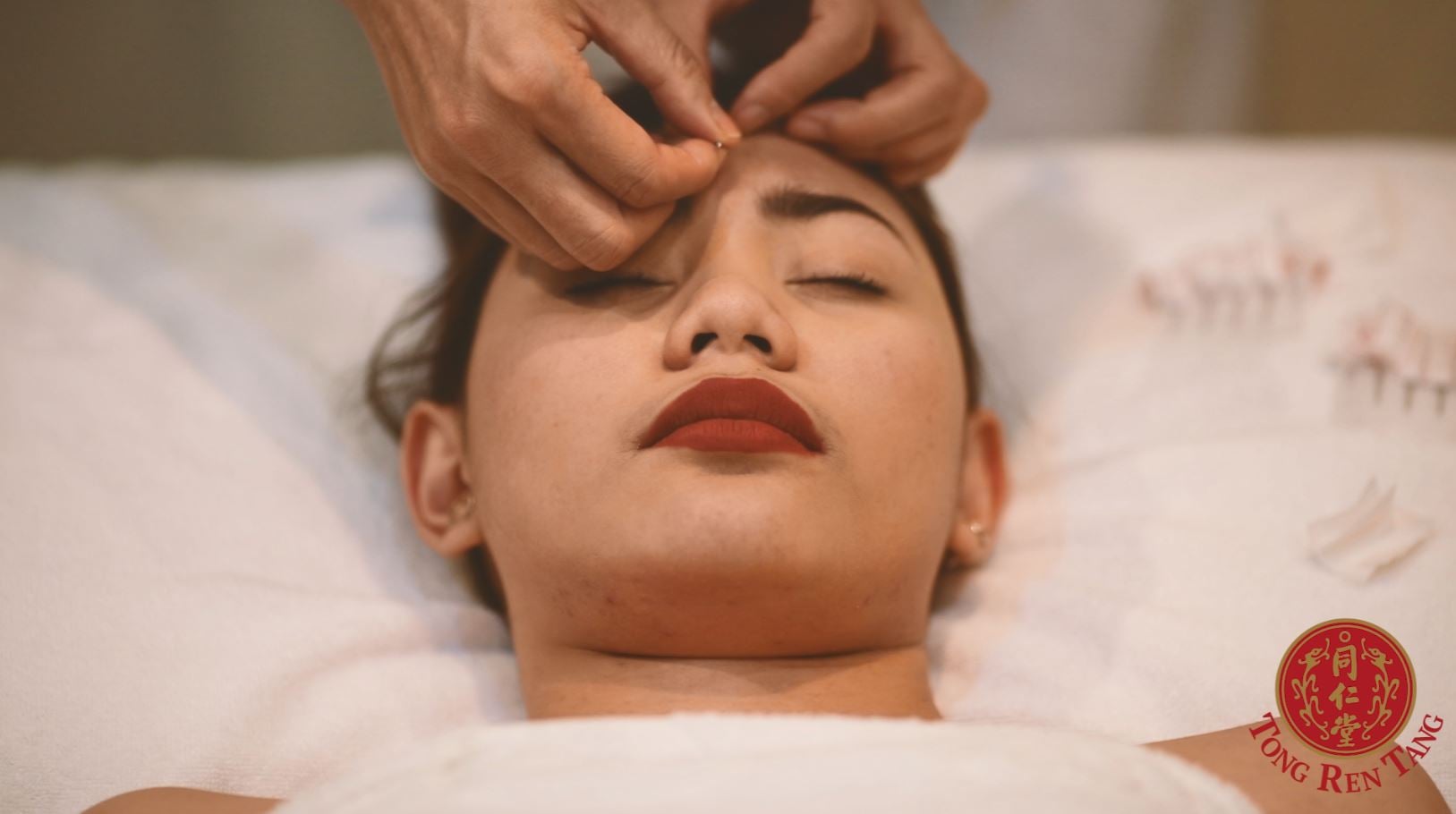 ACUPUNCTURE 6