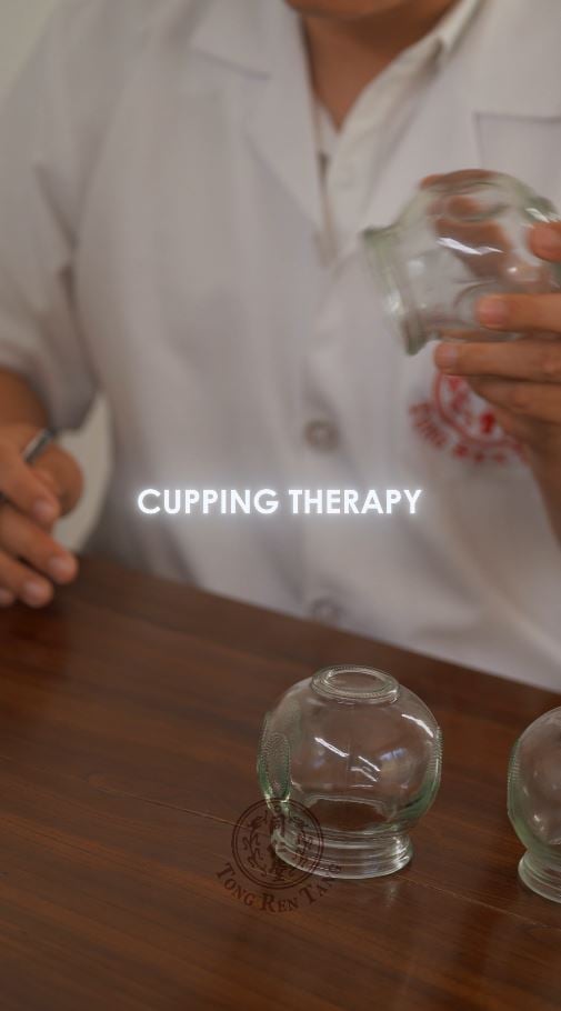 CUPPING
