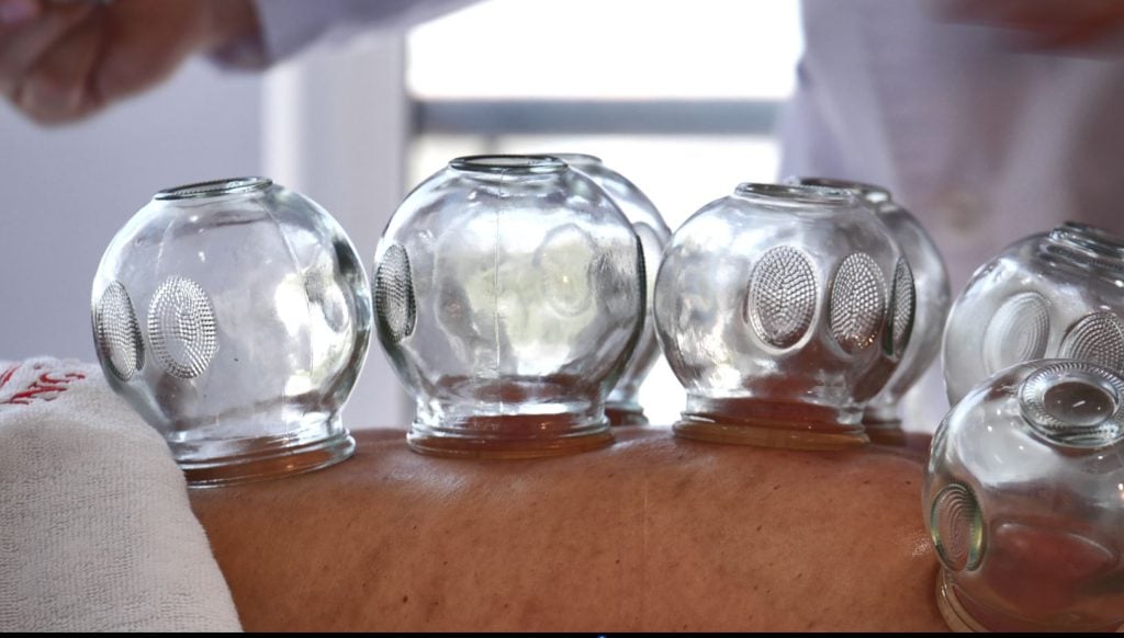 Cupping Cups