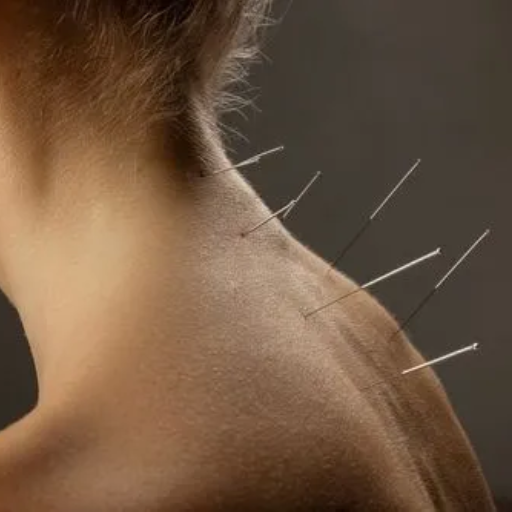 Natural Neck Pain Relief TCM Approaches That Work
