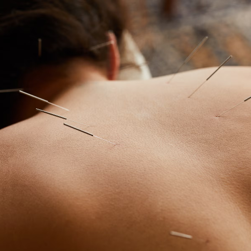 Common Techniques in Acupuncture Treatment