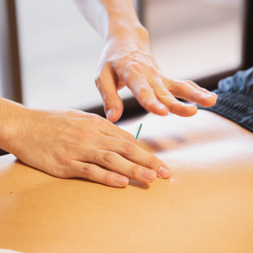 Acupuncture: An Overview