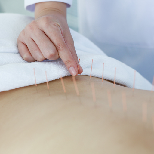 Comparing Treatment Options for Sciatica
